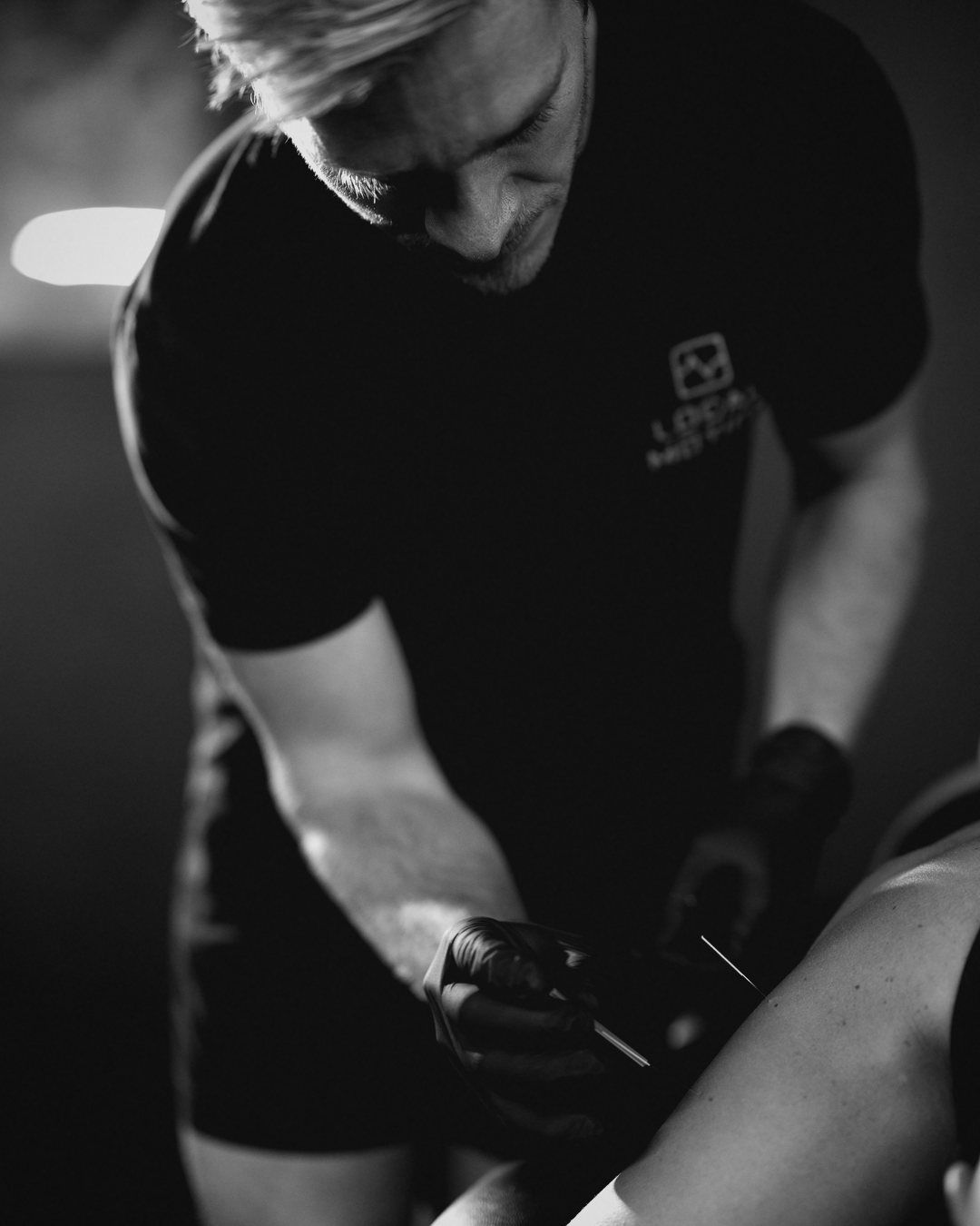 Dry needling